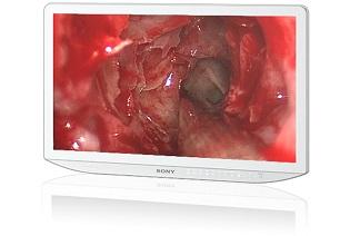 Medicinski - medical monitorji